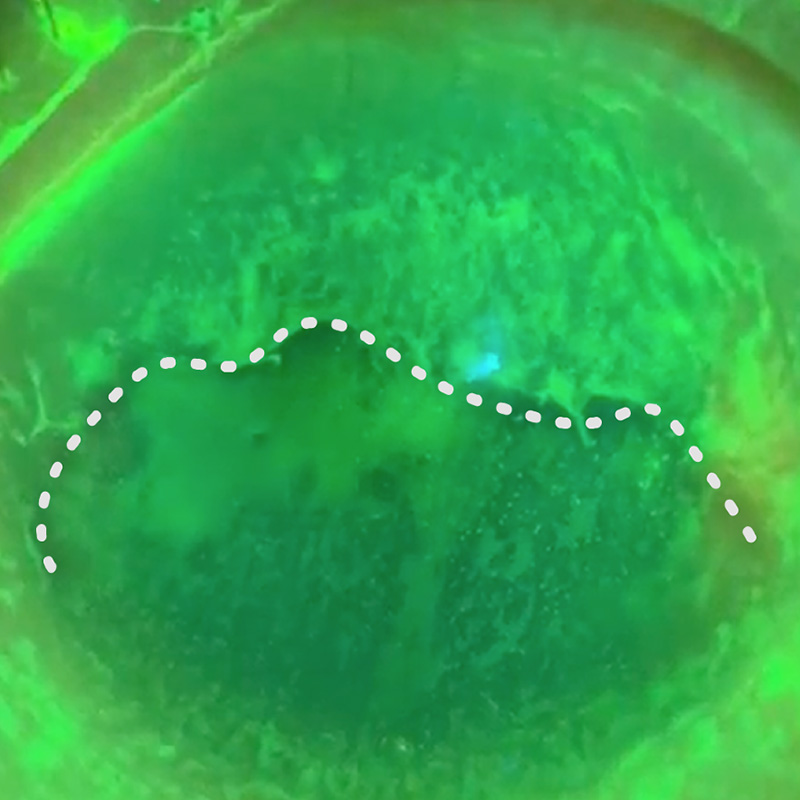 LSCD image 1