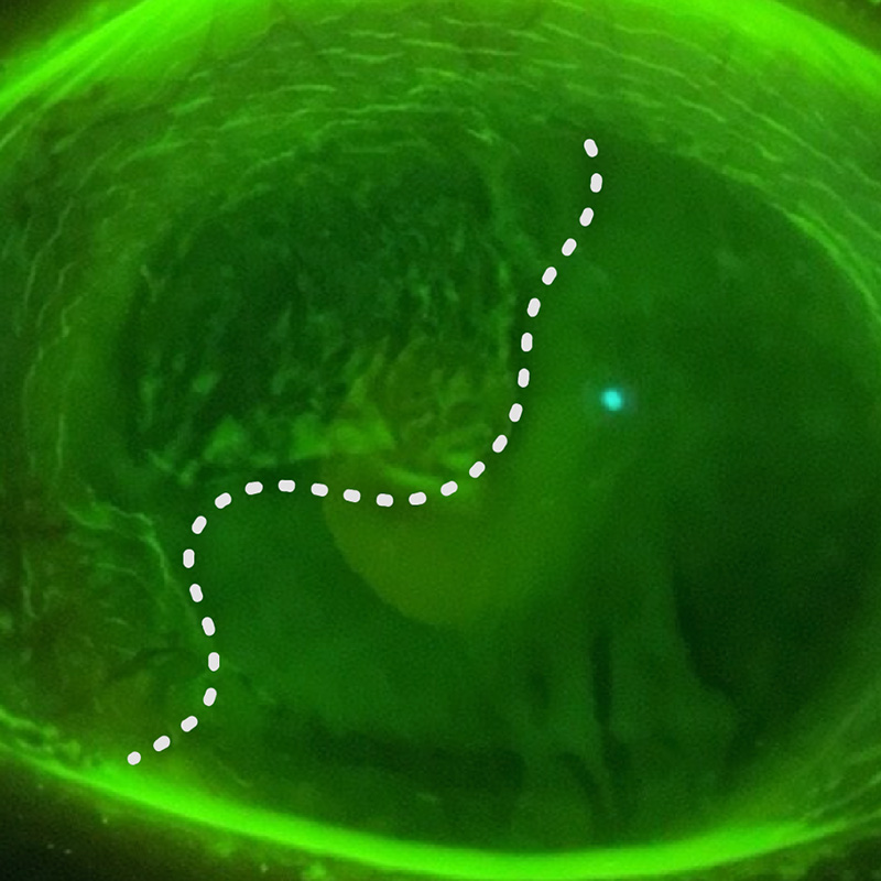 LSCD image 2
